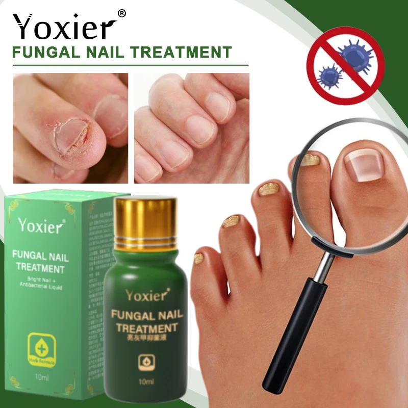 

Nail Fungus Therapy Serum Nail Health Care Solution Repair Renew Damaged Onychomycosis Relieve Nail Loss Regeneration 10ml