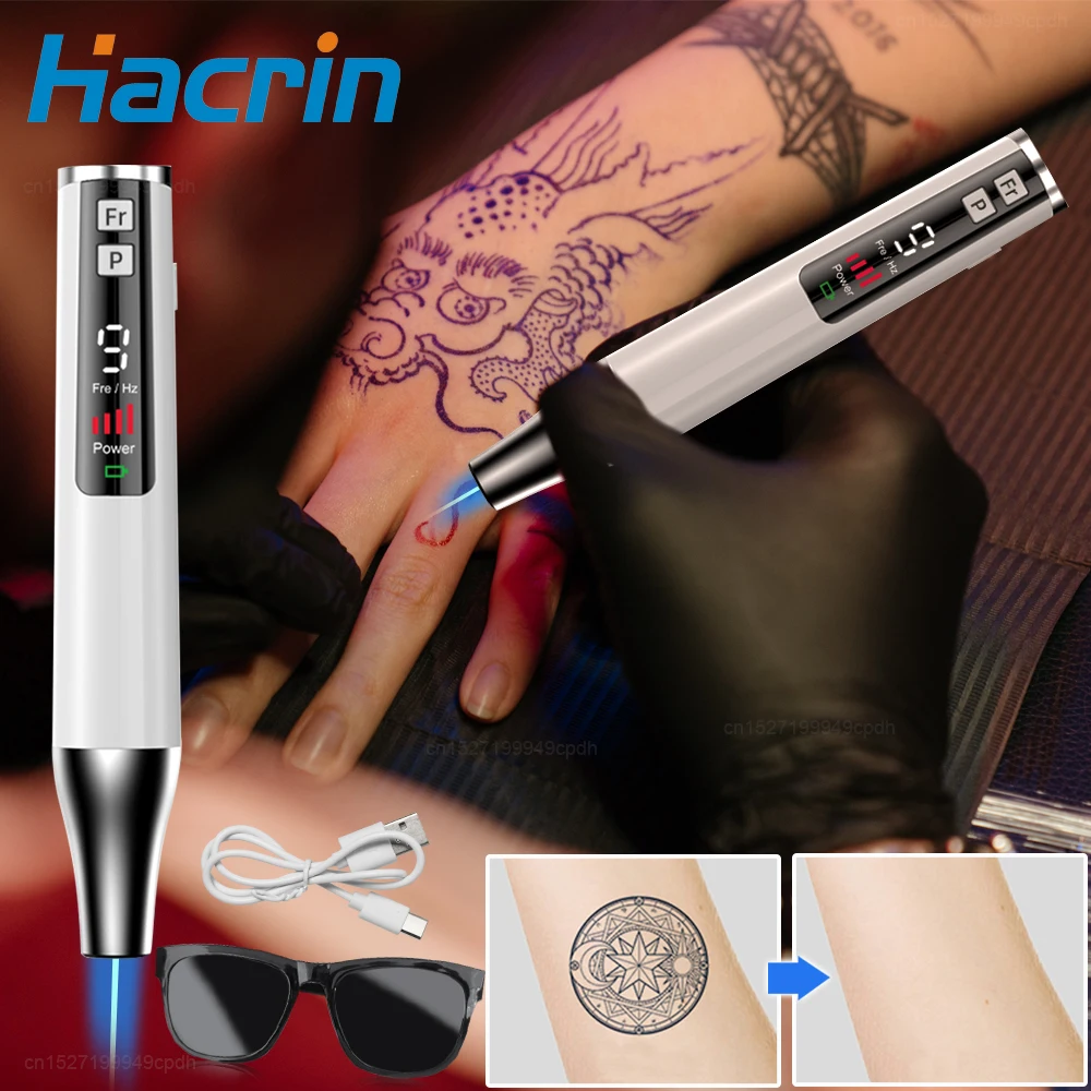 

Пикосекундная лазерная ручка для удаления татуировок, лазерная указка, электронный Устранитель бородавок, средство для удаления акне, темных точек, веснушек, родинок, жетон для кожи, прыщиков