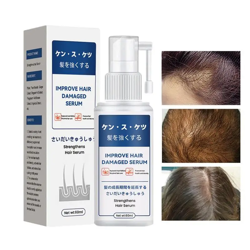 

Fast Hair Growth Essence Spray Anti Hair Loss Serum Prevent Baldness Scalp Dry Damaged Beard Hair Care Essential Oils 60ml