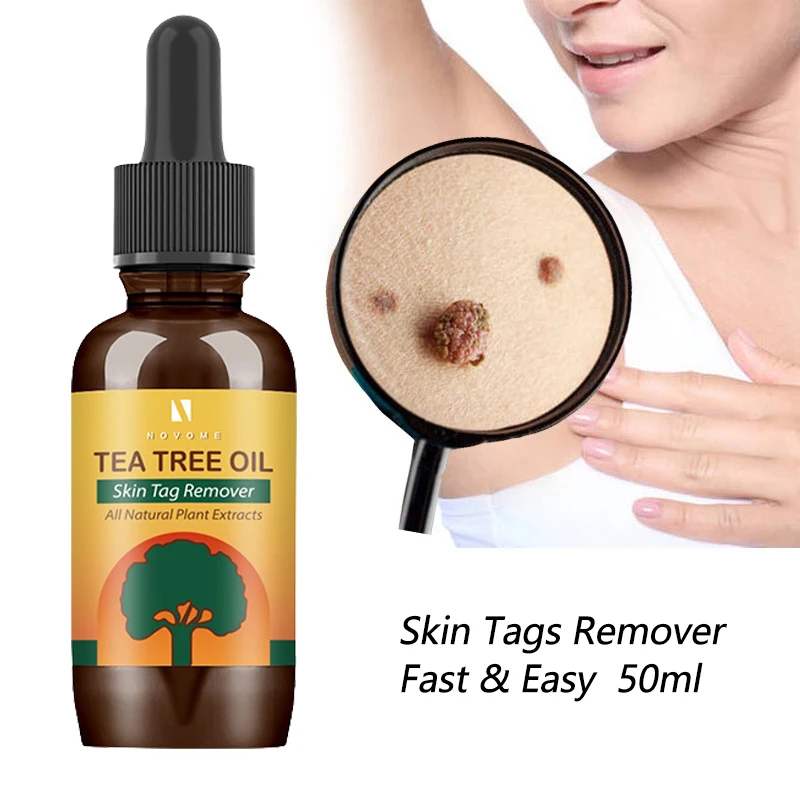 

Wart Treatment Cream Wart Removal Antibacterial Essential Oils Skin Tag Removal Foot Corn Moles Acne Herbal Oils