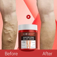 auquest varicose veins treatment body cream vasculitis phlebitis spider pain relief ointment medical herbal plaster health care