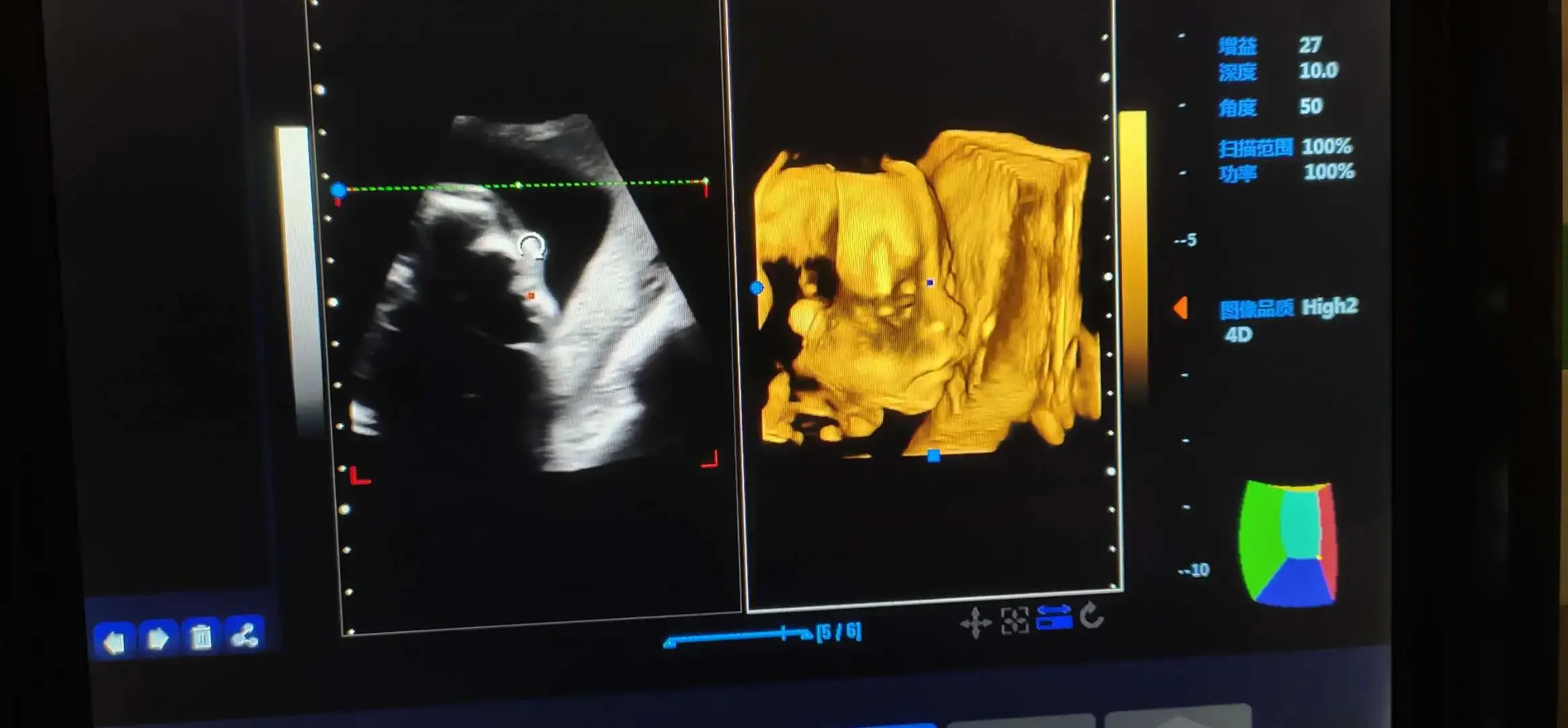 Рисунок 6 - Медицинская ультразвуковая машина