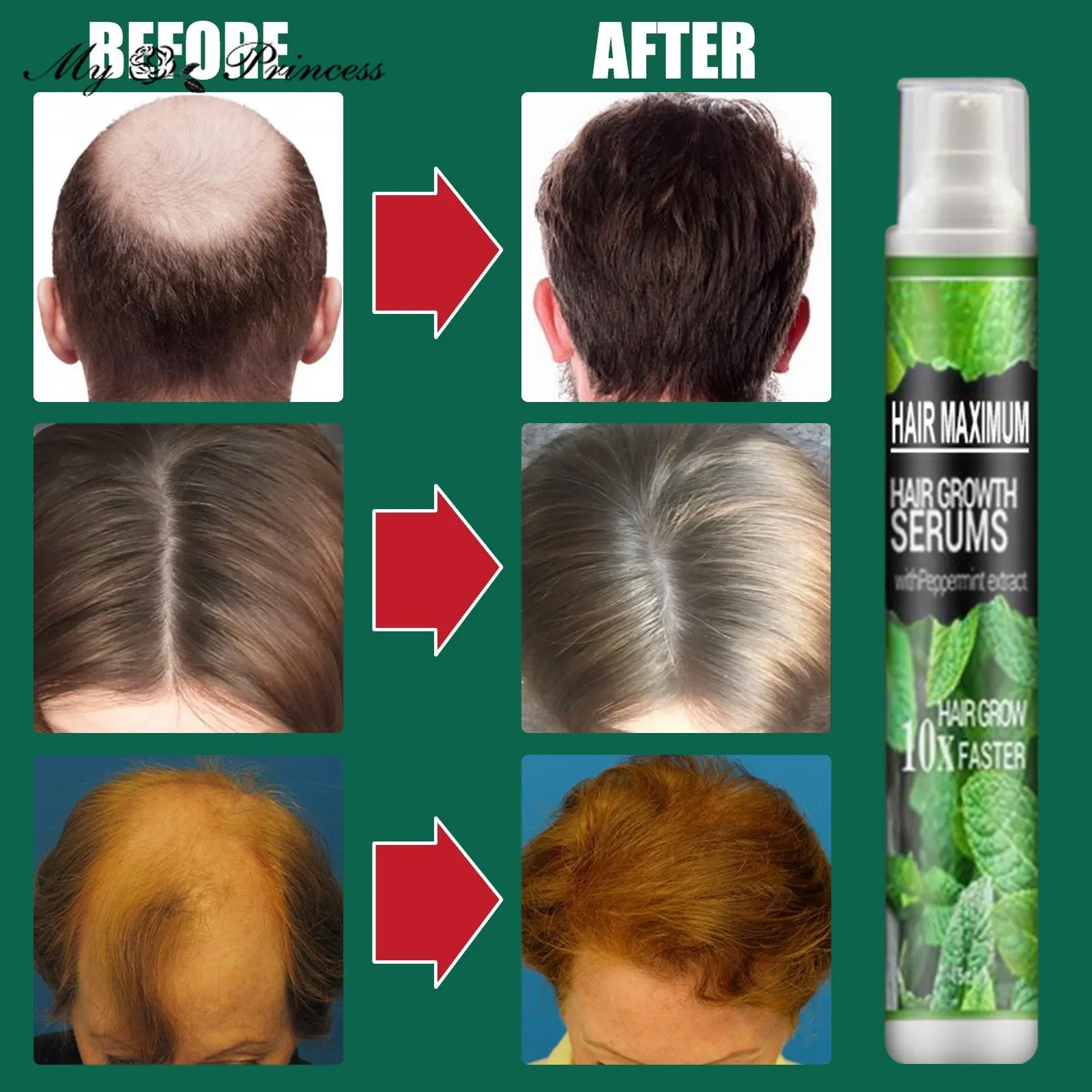 Hairrebirth Herbal Spray Herbal Hair Growth Maximizer Spray Daily Nourishing Spray Hair Serum Spray
