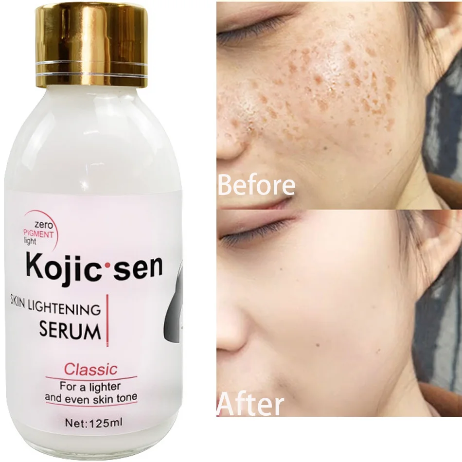 

125ml Kojic Acid Serum Strong Brightening Whitening Cream Spots Fine Lines Lighten Skin Tone Rejuvenating Antiage Korean Facial