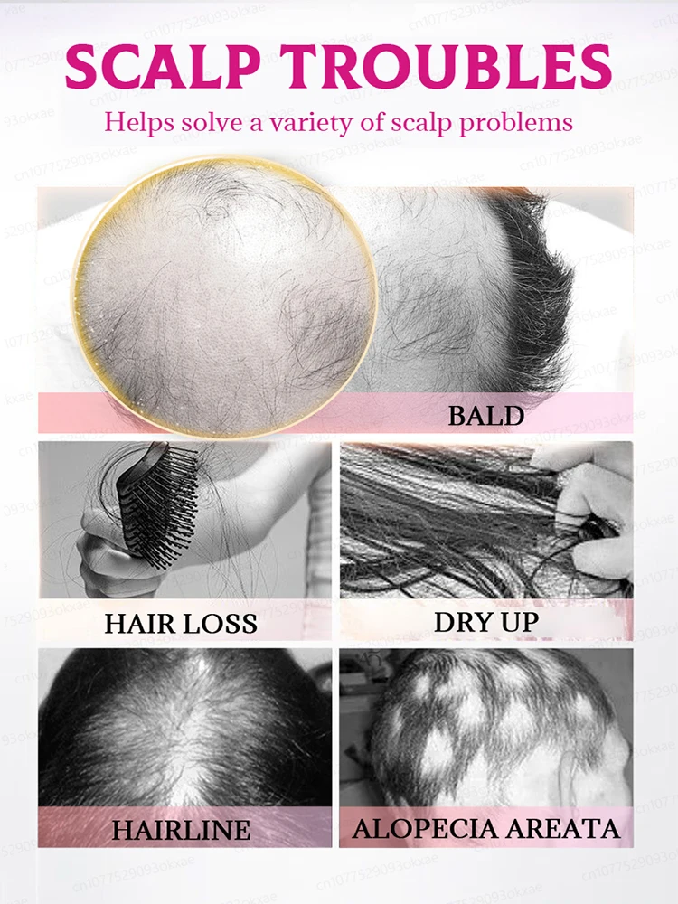 Массаж и расслабляет кожу головы для снятия стресса выпадения волос.