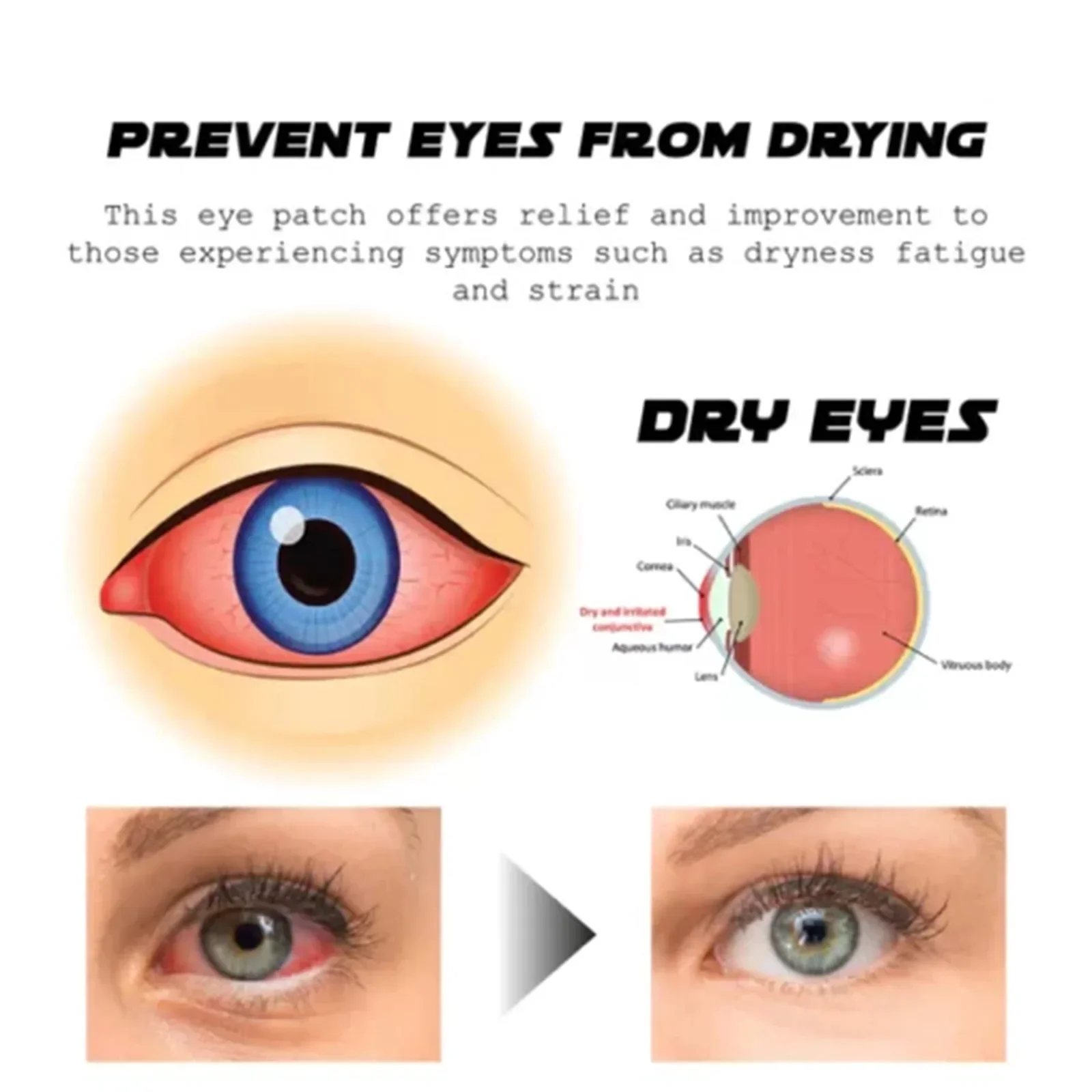20 шт. наклейки для глаз от сухой усталости и близорукости