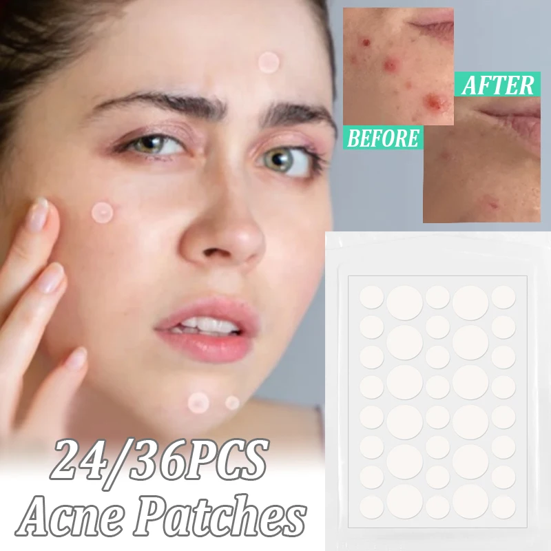 

Ultra-thin Acne Pimple Remover Patches 24/36 Patches Invisible Acne Treatment Stickers Kit Blemish Spot Skin Face Care Care Tool