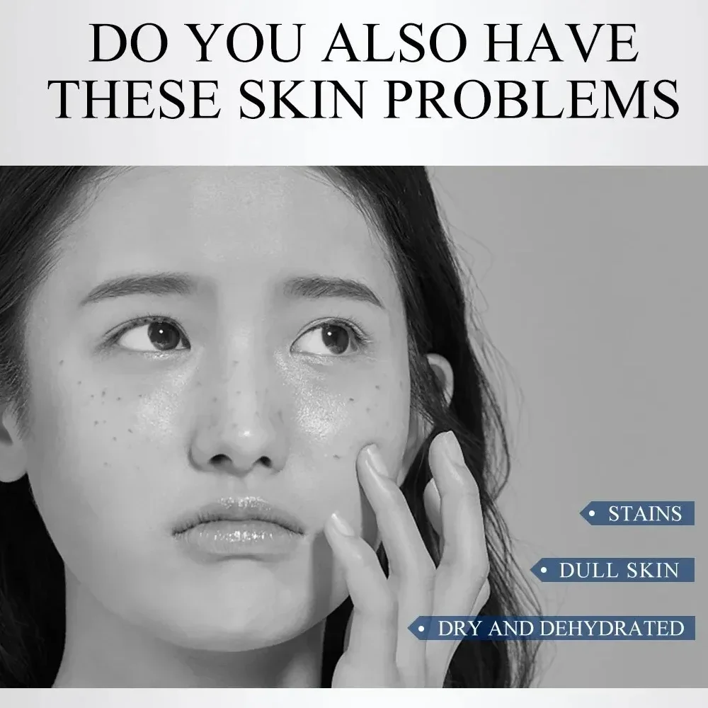 Отбеливающий крем для кожи против веснушек удаляет пятна меланина уменьшает