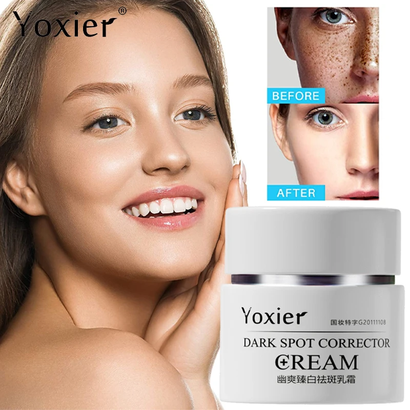 

Face Cream Remove Dark Spots Age Spots Chloasma Moisturizing Lighten Pigmentation Whitening Deep Nourishment Repair Face Care