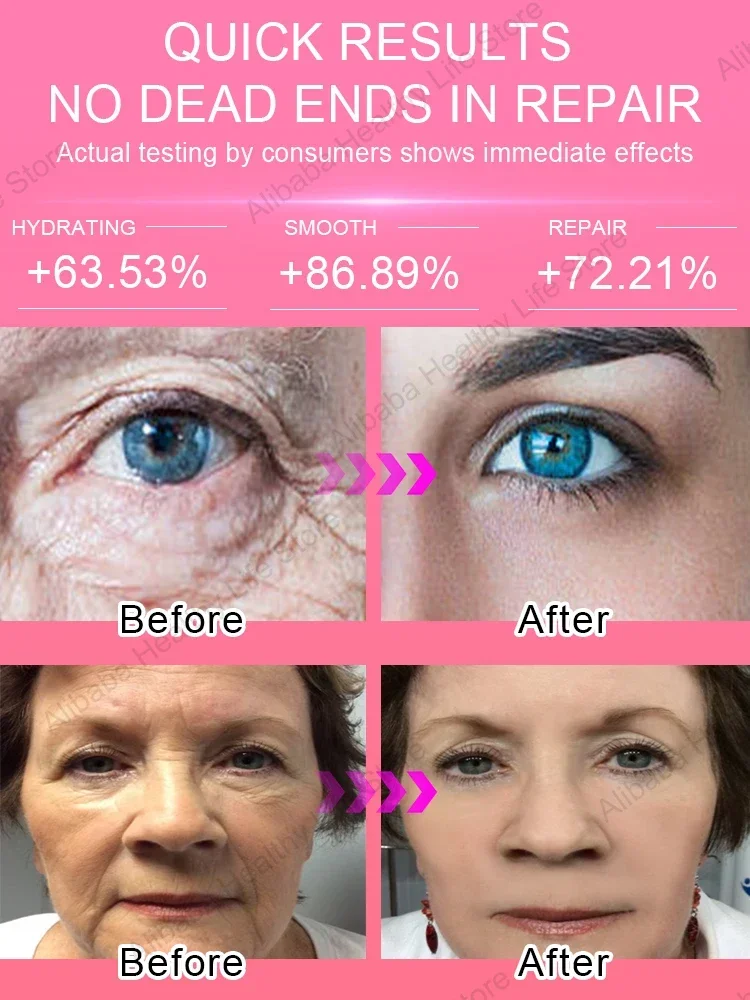 Завершите возрастное беспокойство! Сделайте себя уверенно! Будьте еще 20!