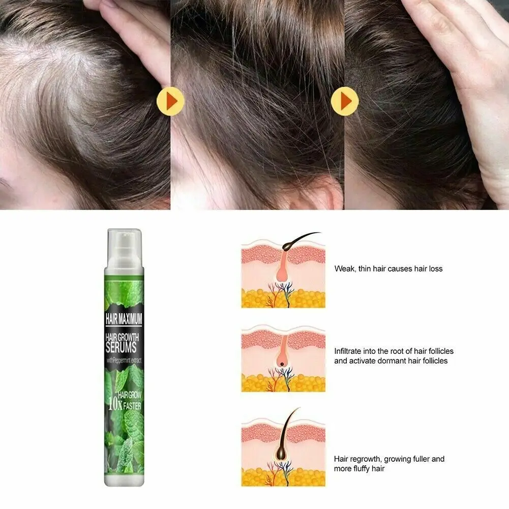 Serum Anti Hair Loss Fast Grow Prevent Hair Dry