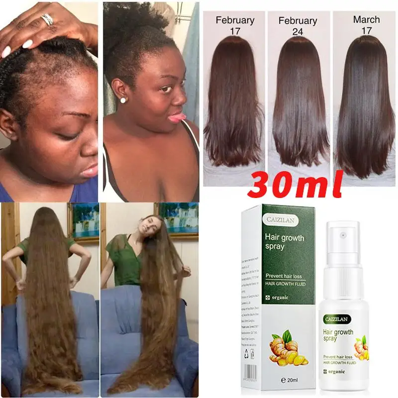 

Hot Sale Professional Ginger Anti Hair Loss Hair Growth Spray Essential Oil Liquid Care Hair Loss Products ReGrowth Ginger Spray