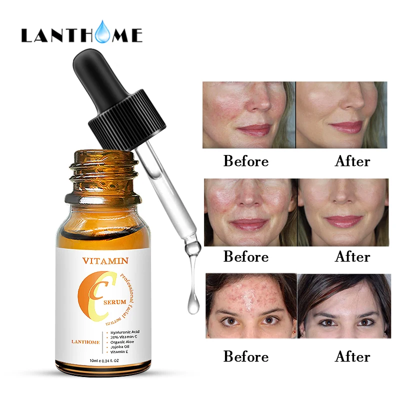 

Vitamin C Face Serum Whitening Shrink Pores Essence Fade Dark Spots Freckle Face Care Anti Aging Moisturizing Facial Skin Care