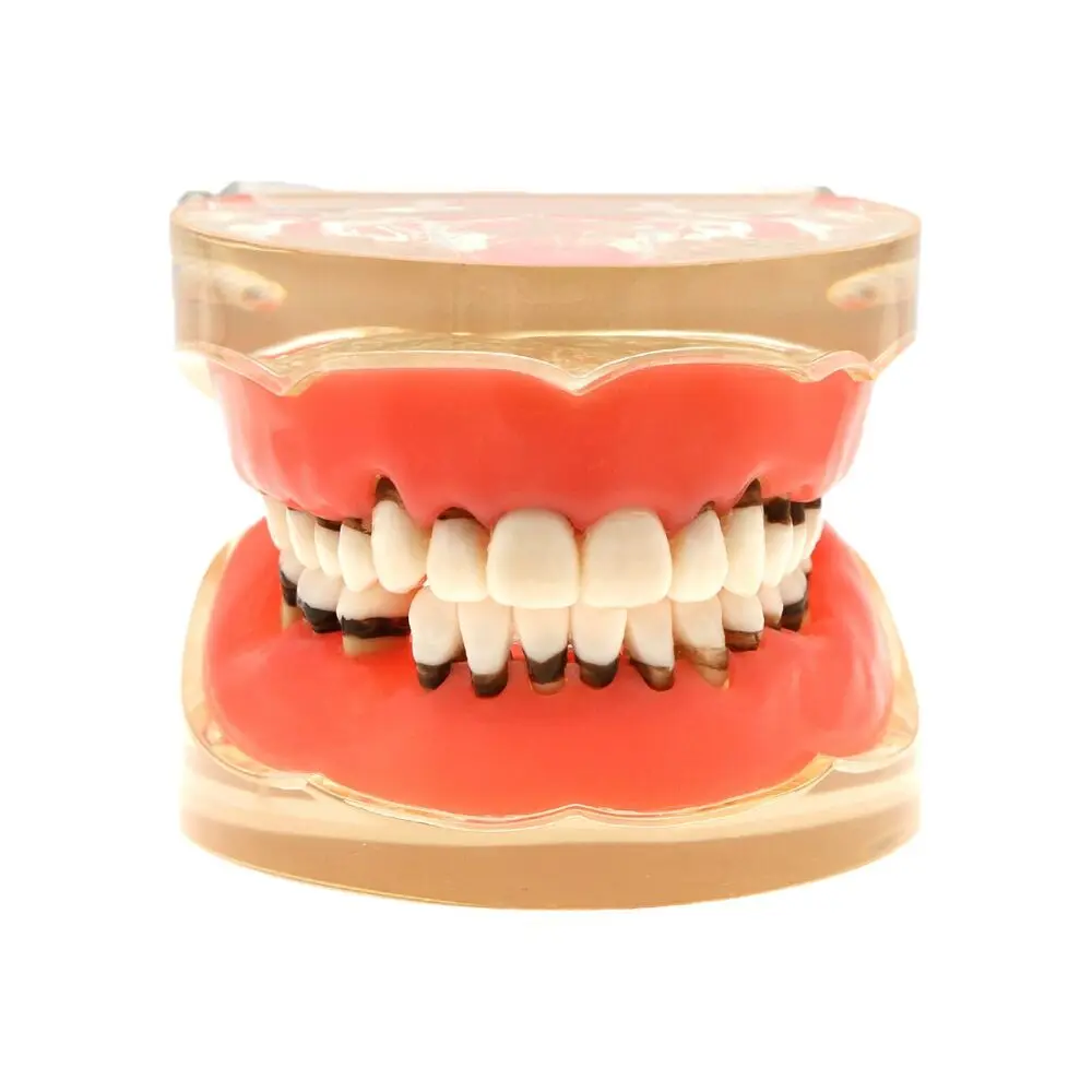 Dental Adult Periodontal Disease Pathological Teeth Typodont Model Removable Gum tooth pick floss dental cepillo interdental