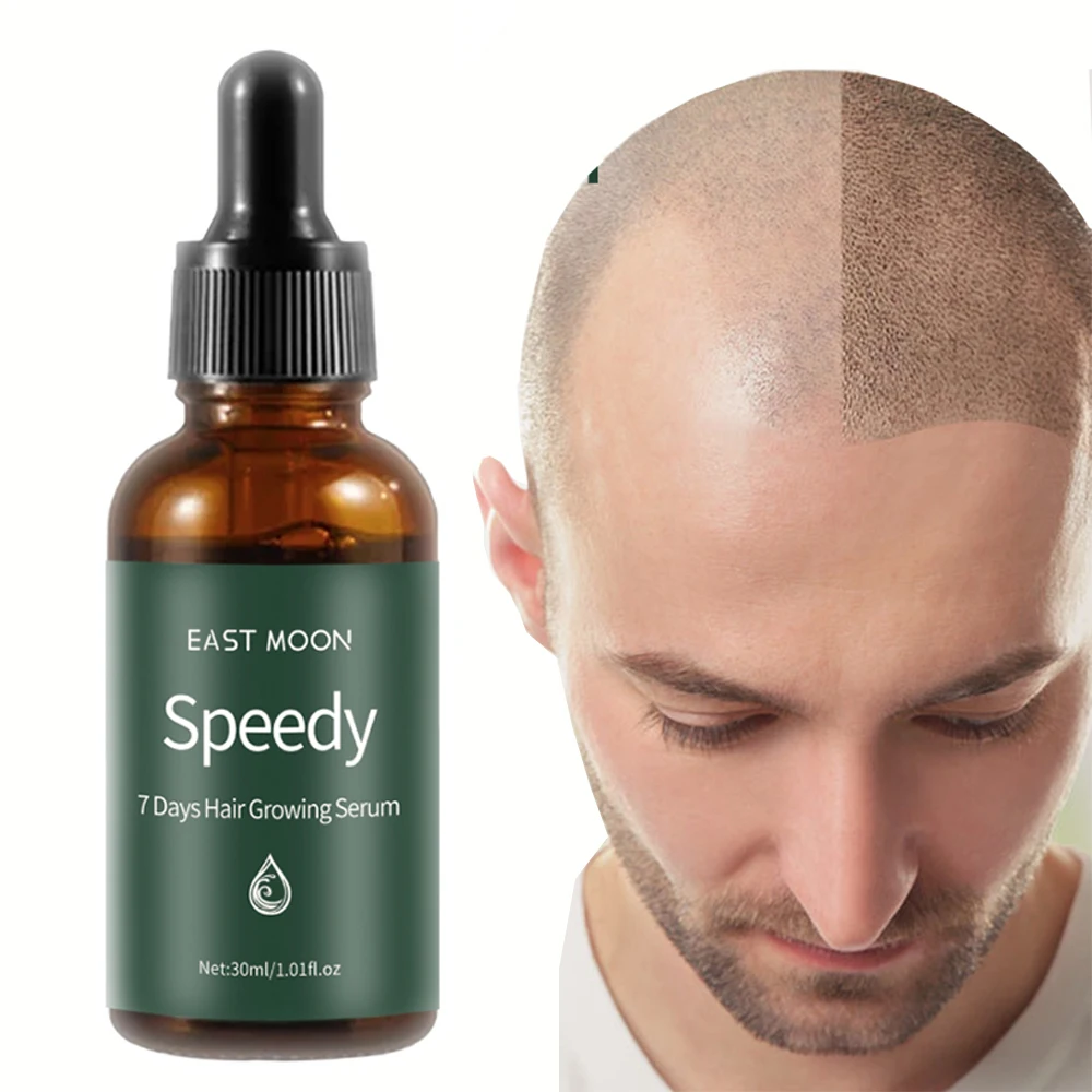 

Hair Growth Grow Essentials Oil Fast Aceite Para Crescimento De Cabello Tratamiento El Cabelo Serum Huile Cheveux Pousse Rapide