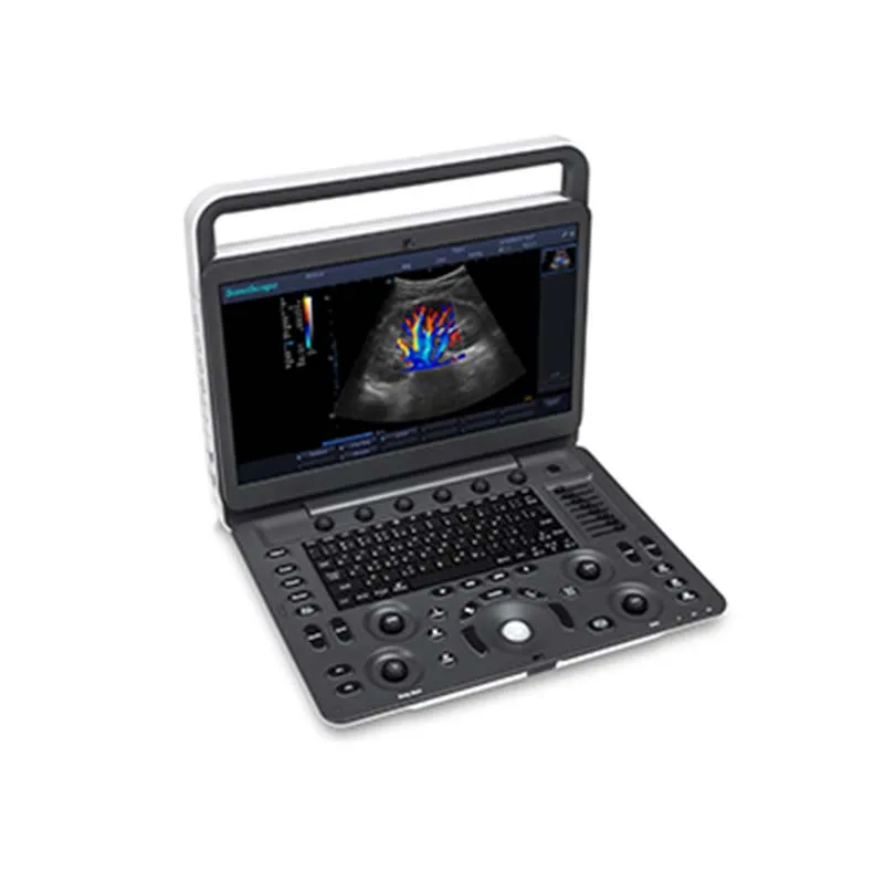 

Recommended Latest factory price of Sonoscape Color Doppler Portable Ultrasound Sonoscape E2 Pro/E2/E3 for Healthy Care Buyer