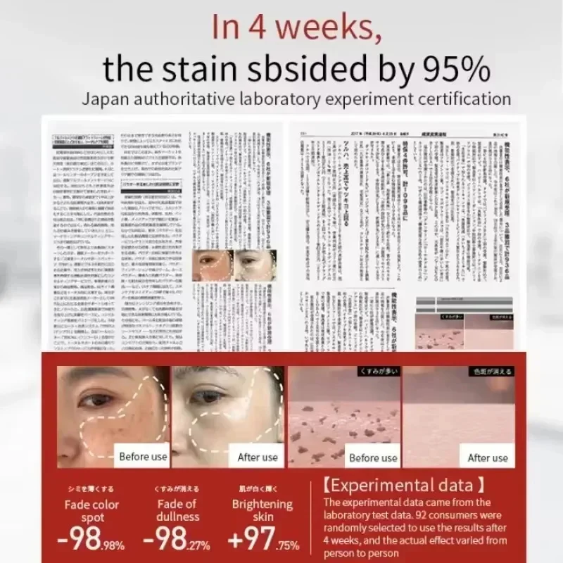 Мощный отбеливающий крем от веснушек удаление мелазмы корректор темных пятен