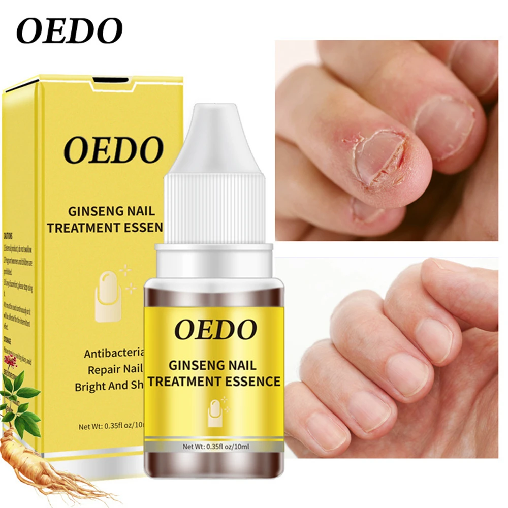 

OEDO Nail Essential Oil Nail Repair Liquid Wholesale Enjoy More Discounts