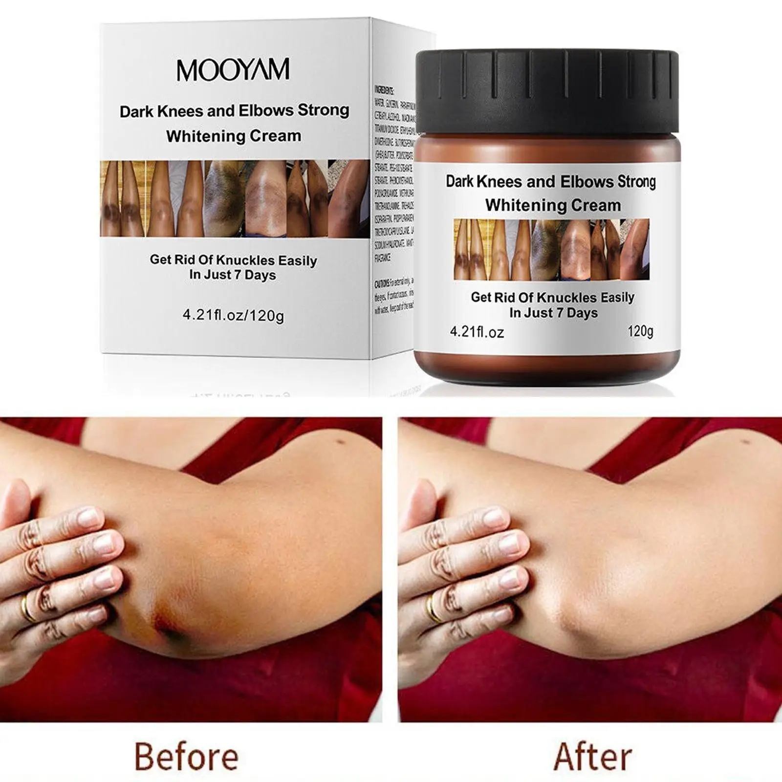 

Get Rid Of Dark Knuckles In 7 Days Serum Whitening Removing Dark Knuckles Serum Hand Knuckle Eraser Serum For Elbow And Knee