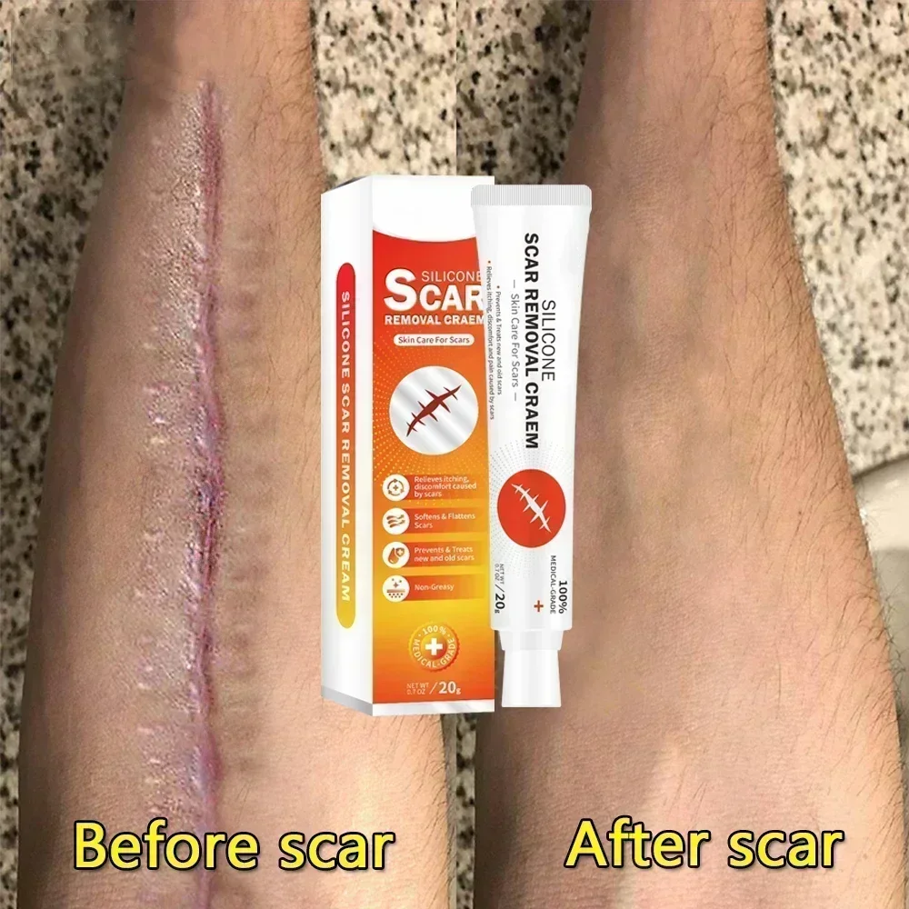 Удаление шрамов пятен от прыщей Лечение растяжек Хирургическое сглаживание