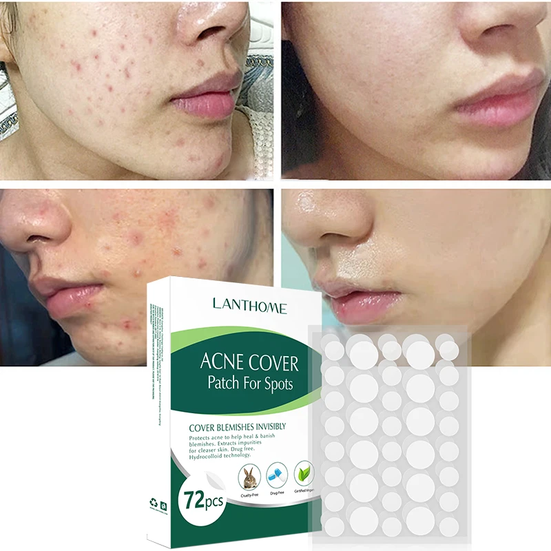 

Невидимый патч-наклейка для лица, быстрое лечение акне, Удаление прыщей, инструмент для красоты, уход за кожей