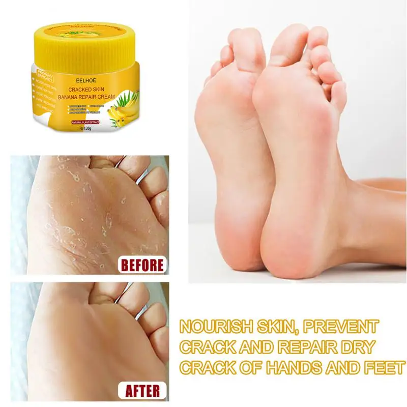 

20g Banana Cream Anti-Drying Crack Heel Balm Cracked Repair Foot Cream Dead Skin Removal Banana Oil Feet Care TSLM1 Wholesale