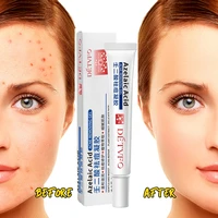 effecti acne scar removal cream gel anti acne treatment face whitening cream oil control fade dark spot pore minimizer skin care