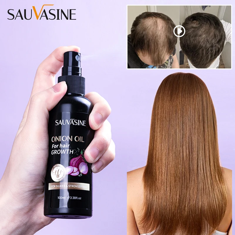 Onion Hair Oil for Fast Hair Growth Essential Oil Anti-hair Loss Oil Head Scalp Treatment for Men and Women Hair Growth Product