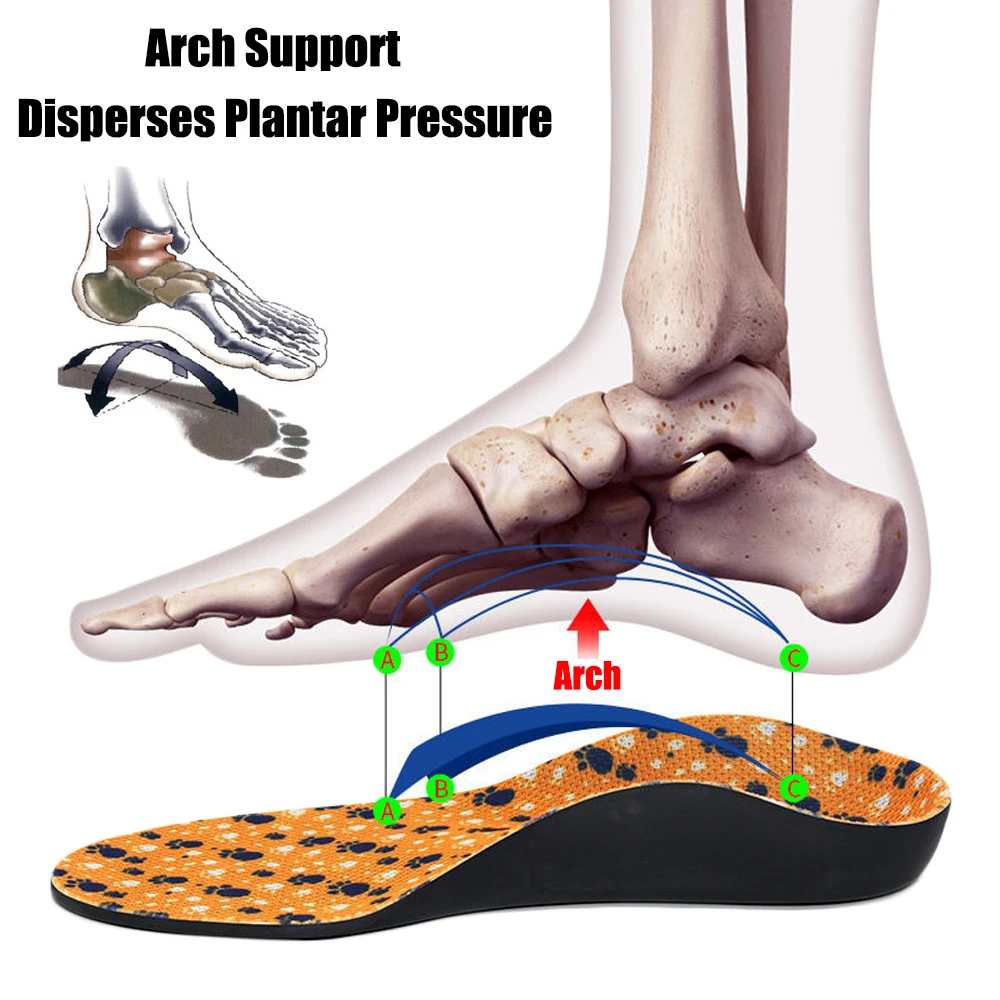 Kids Flatfoot Orthopedic Sport Insoles for Shoes Children Orthotics Insoles Flat Feet O/X Leg Correction Arch Support Shoe Pad