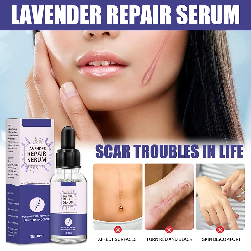 30ml Lavender Face Serum for Acne Prone Sensitive Skin Care Repair Essence Scar Removal Oil |