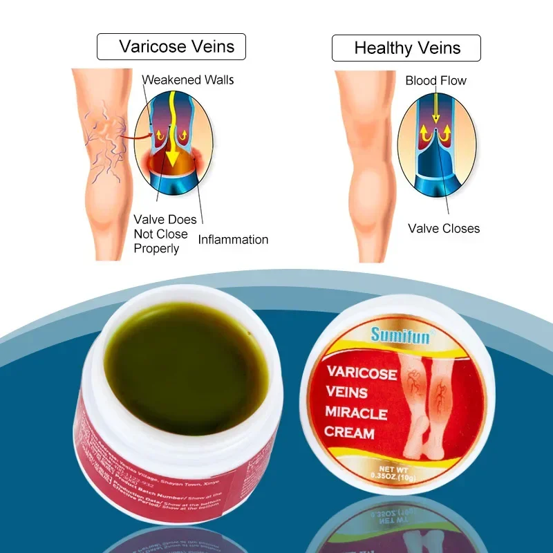 Мазь Sdotter для облегчения варикозного расширения вен крем боли в ногах форме паука