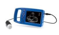 ultrasound scanner price morocco