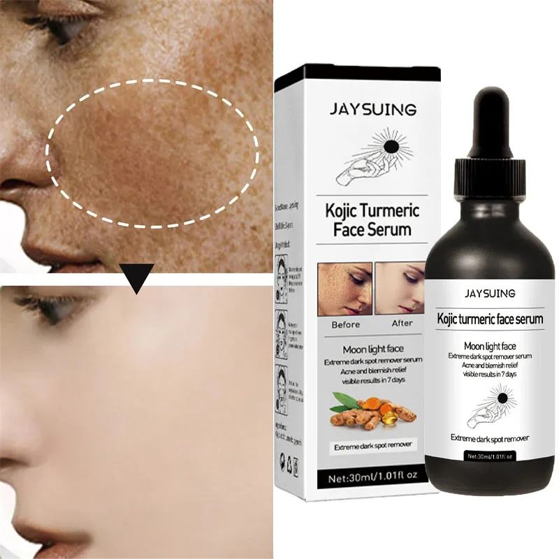 

Turmeric Freckle Whitening Serum Curcumin Oil Fade Dark Spot Remove Pigment Improve Dull Melanin Corrector Beauty Face Skin Care