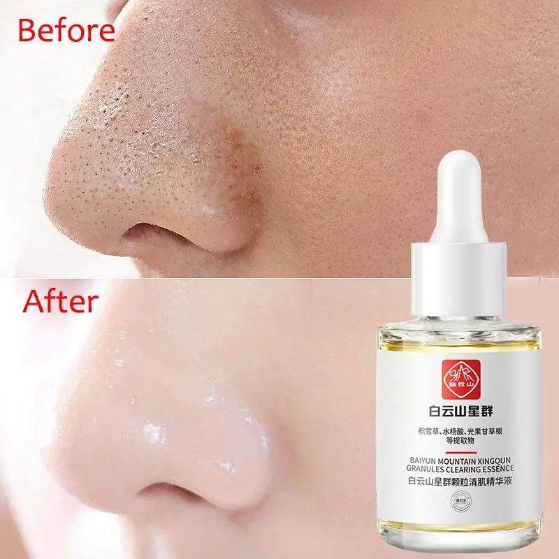 

Lactobionic Acid Pore Shrink Face Serum Hyaluronic Nourish Essence Korean Firm Smooth Acid Repair Pores Cosmetics Moisturiz G9Y2