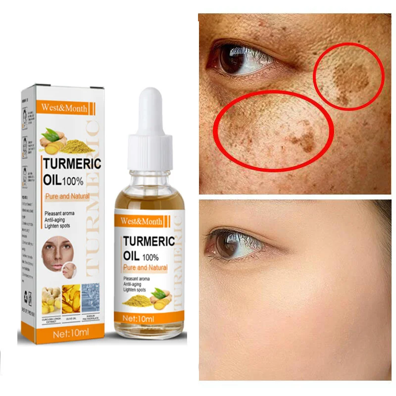 Turmeric Whitening Freckles Serum Remove Dark Spots Melasma Brighten Lighten Melanin Improve Dull Anti-aging Face Skin Care 10ml