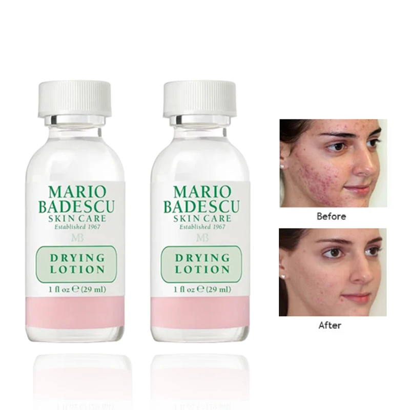 Эффективное лечение акне 30 мл сушильный лосьон Mario Badescu сыворотка против Удаление
