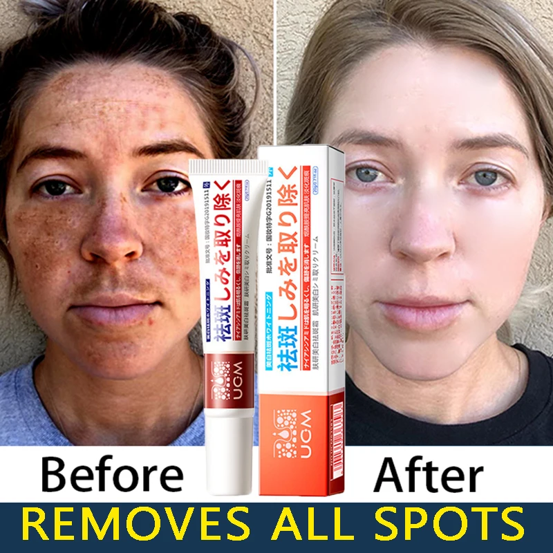 Powerful Whitening Freckle Cream Remove Melasma Dark Spot Lightening Melanin Lift Firming Moisturize Anti-aging Face Skin Care