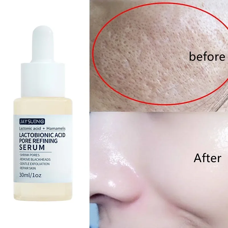 

Lactobionic Acid Shrink Pores Serum Moisturizing Facial Essence Liquid Purify Pore Treatment Beauty Skin Care whitening cream