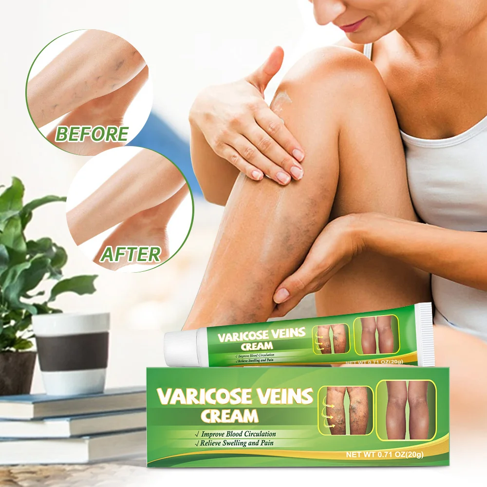 Мазь для устранения варикозного расширения вен