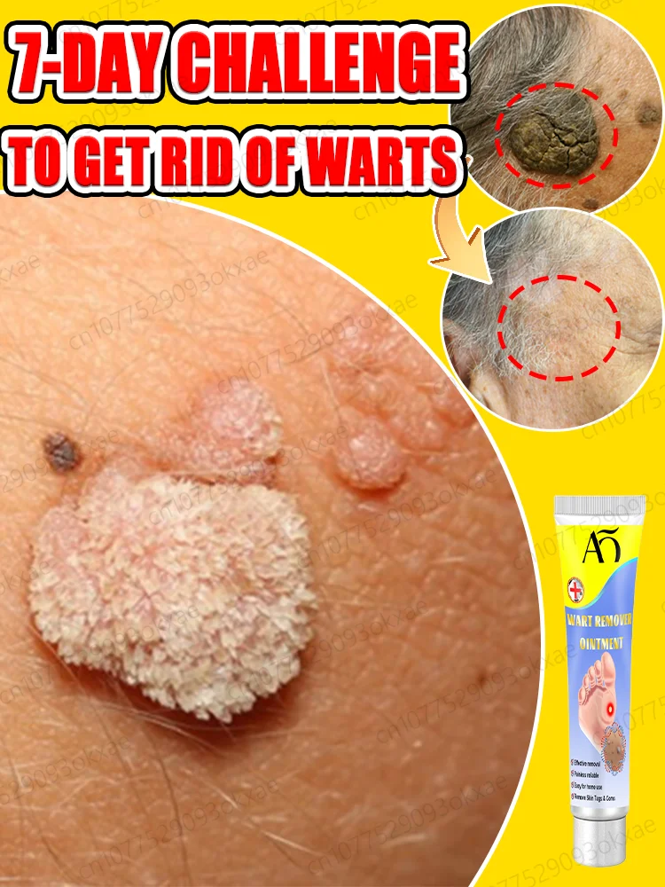 ᵂᵗ ᵗ ᵛᵛᵛᵛᵛᶜᵉᵉᵉᵐ ᵐ ᴾᴾᴳʳ ʳ ᵂᵂᵂᵂᵂᵂᵂᵂˢ ˢ