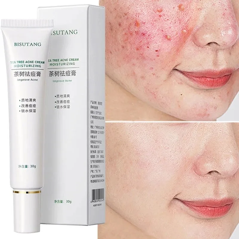 Effective Acne Removal Cream Shrink Pores Oil Control Remove Pimples Pox Tea Tree Acne Gel Treatment Moisturizing Whitening Skin