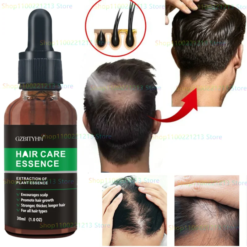 

Anti-hair loss care essential oil plant extract old ginger ginseng moisturizing and strengthening hair roots to prevent hairloss