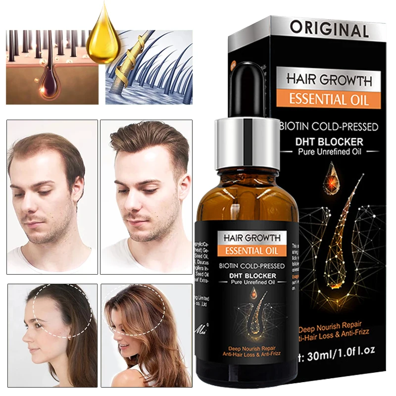 

Hair Growth Shampoo Essential Oil Anti Hair Loss Ginger Serum Repair Damaged Anti-Dandruff Regrowth Scalp Treatment 30ml/250ml