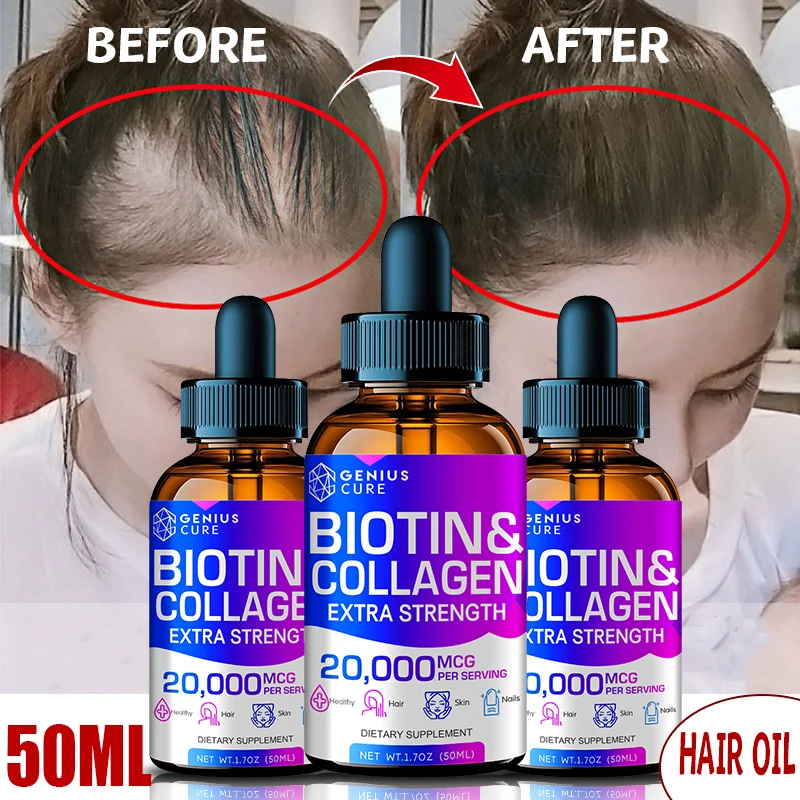 

Hair Growth Liquid Rapid Hair Growth Repair Damage Care Scalp Anti-hair Loss Male and Female Hair Care Essence