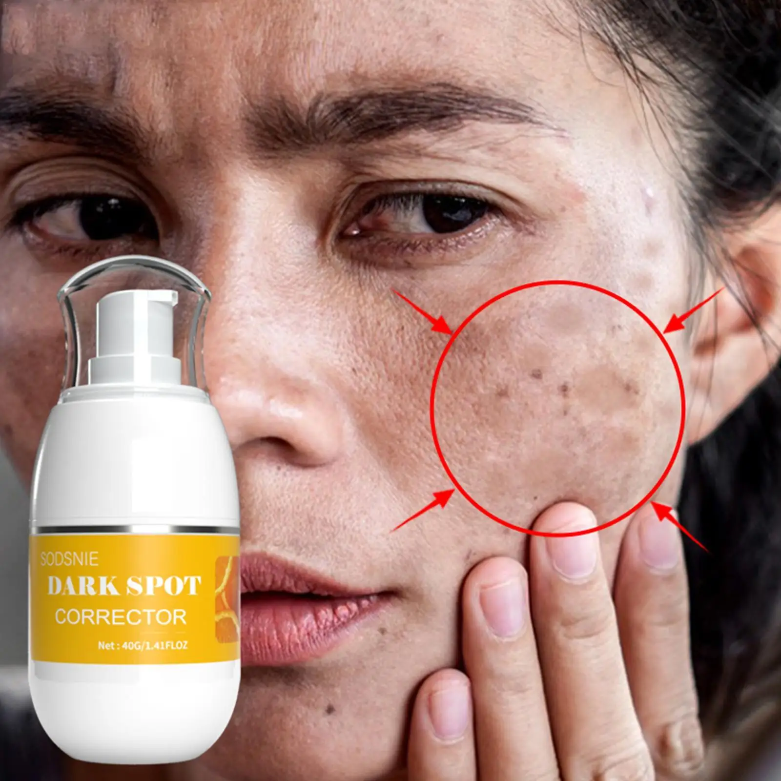 

40g Dark Spot Corrector Moisturizing Effectively Removes Dark Spots Chloasma Age Spots Sun Spots Whitening Brightening Skin Care