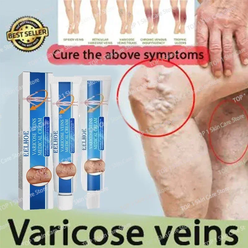 Восстанавливающий крем от варикозного расширения вен Tongmai эффективное