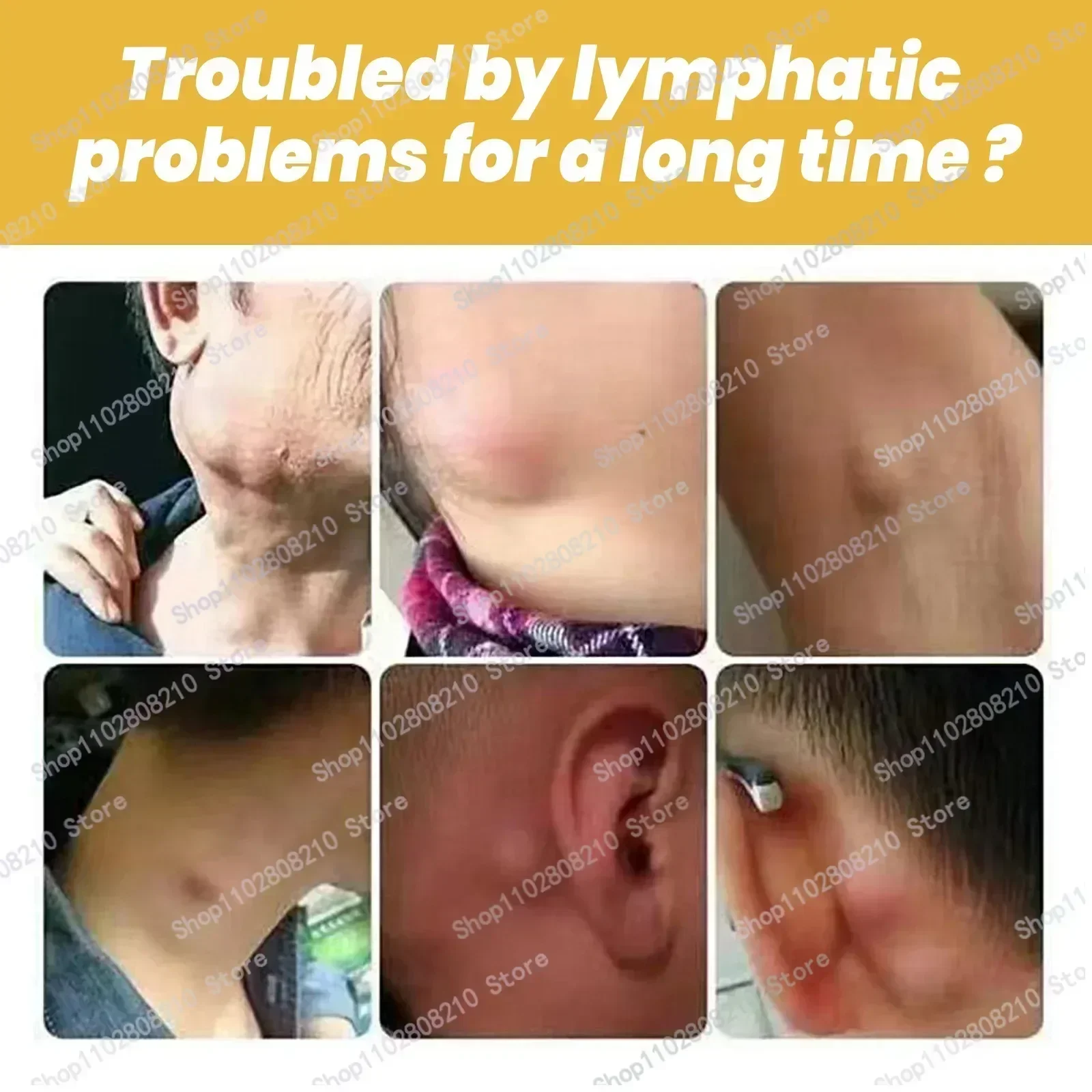 ГОРЯЧИЙ ~ Удаление губ облегчение боли против тунковой отек отеки кожи