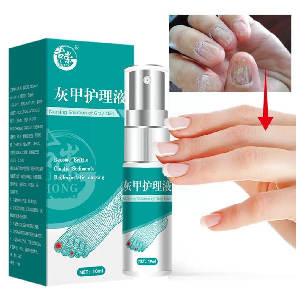 

Nail Fungus Treatment Spray Anti Infection Paronychia Fungal Onychomycosis Removal Foot Nail Beauty Products Serum Hand Hea B8C4