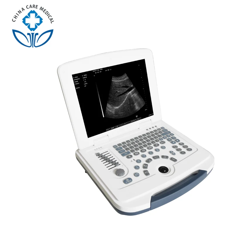 

2020 Ecography Usg Ultrasound Machine Price