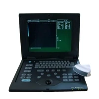 ce portable ultrasound machine cheapest 3d color doppler ultrasound medical ultrasound instruments